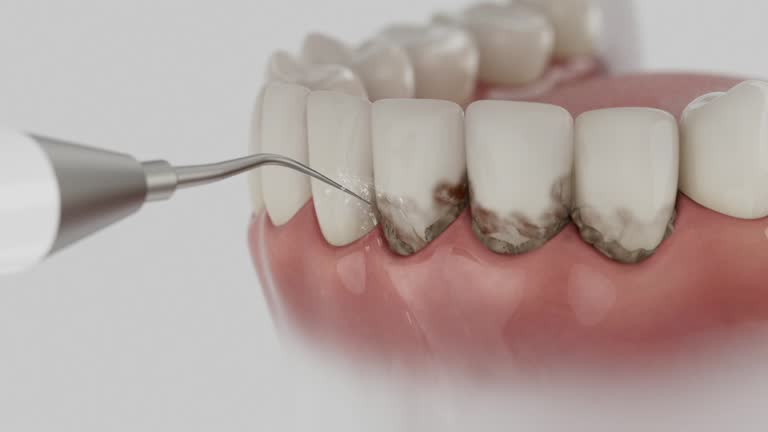Trusted Dental Implants service in Cherryville, PA - Dentist Open Now